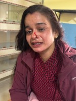 वीरगञ्ज–७ मा ज्यान मार्ने प्रयासको आरोप, कुटपिटबाट महिला अस्पताल भर्ना