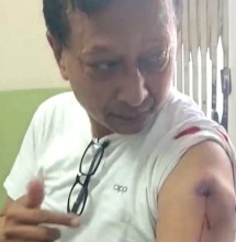 पत्रकार श्रेष्ठलाई प्रहरीको  गोली लाग्यो