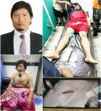 सहकारी पीडित र घाइतेहरूको तर्फबाट कुशलबलाई मन्त्री बनाउन माग